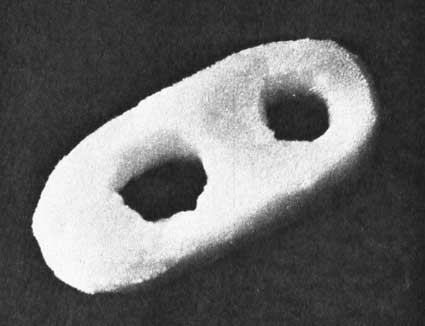 заболевание ног при поперечном плоскостопии защитник