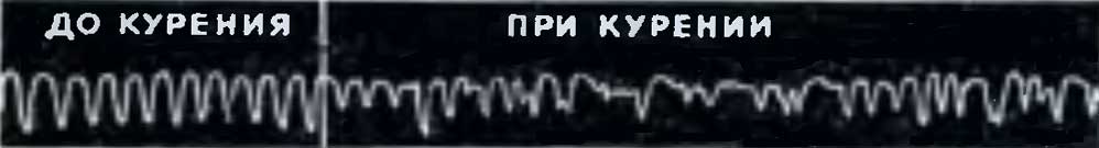 Рефлекторные изменения дыхания у курильщиков Рефлекторные изменения дыхания у курильщиков