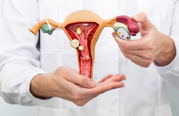 Лечение пролапса матки