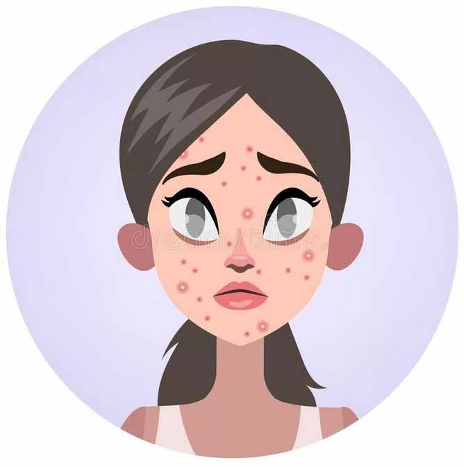 лечение акне или угревой сыпи в клиники эффективно и недорого