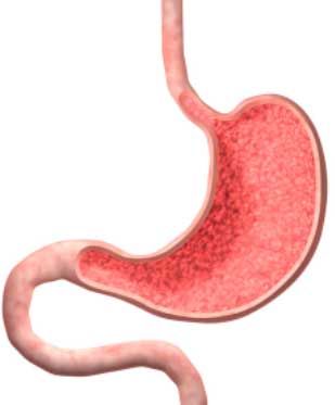 Эрозивно-язвенный гастрит записаться на прием к гастроэнтерологу